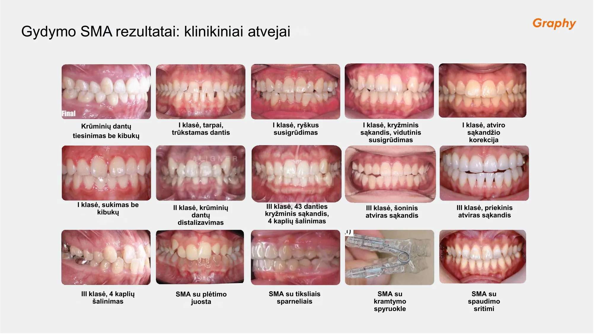 Gydymo SMA rezultatai ir klinikiniai atvejai