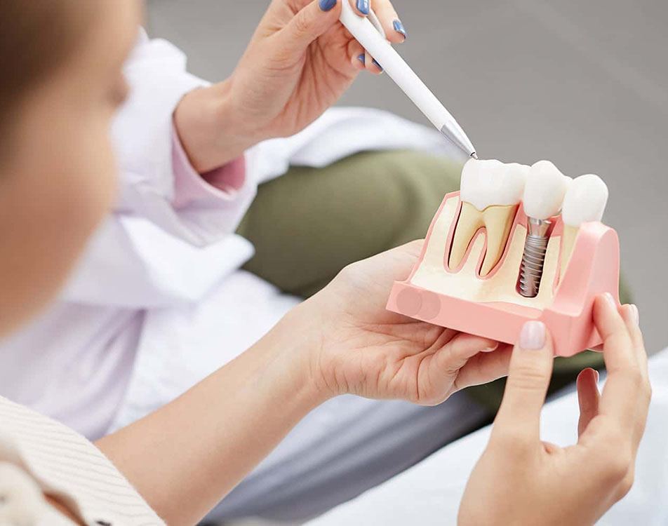 Dantų Implantacija ir Bioimplantai
