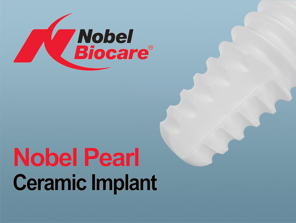 Nobel Biocare Pearl bioimplantas