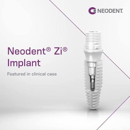 Neodent Zi
